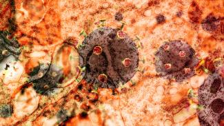 Stylisiertes Bild des neuartigen Corona-Virus.