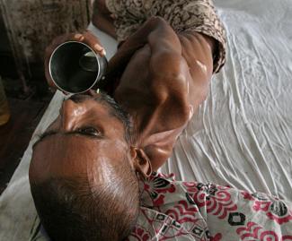 Tuberkulose-Patient in Kalkutta 2009.